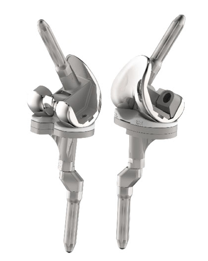 corentec-lospa-knee-system