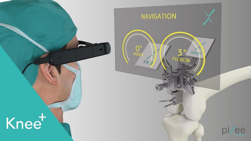 knee + plus