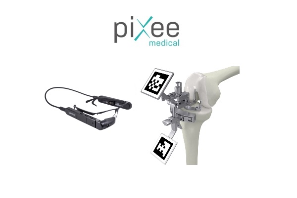 Pixee orthopaedic products